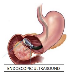 Gastroenterologists In Pune